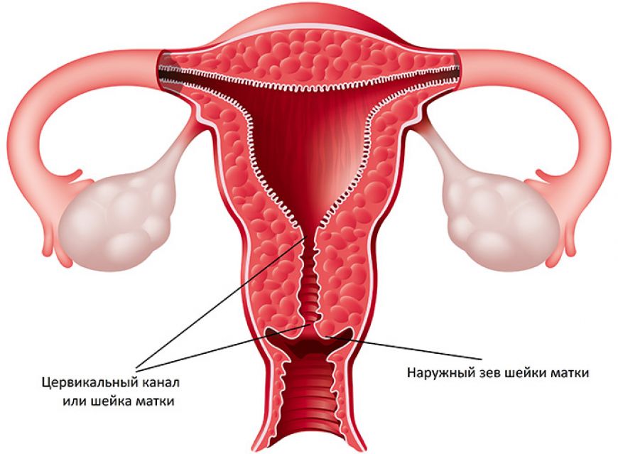 Заболевания шейки матки