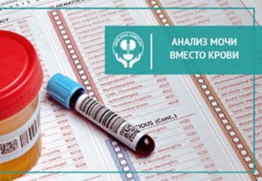 Анализ мочи вместо крови